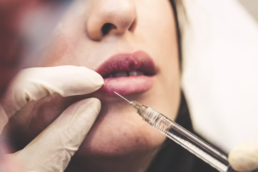 12. Botox And Fillers: What Tourists Should Know